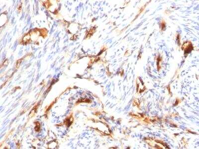 Immunohistochemistry-Paraffin: beta 2-Microglobulin Antibody (B2M/1118) - IHC-Prediluted [NBP2-48327]