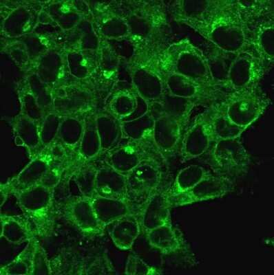 Immunocytochemistry/ Immunofluorescence: beta 2-Microglobulin Antibody (B2M/1118) [NBP2-44467]
