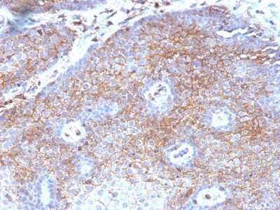 Immunohistochemistry-Paraffin: beta 2-Microglobulin Antibody (B2M/1118) [NBP2-44467]