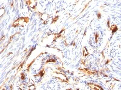 Immunohistochemistry-Paraffin: beta 2-Microglobulin Antibody (B2M/1118) [NBP2-44467]