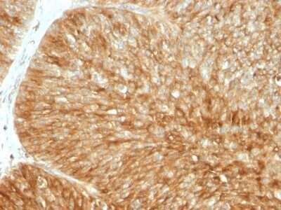 Immunohistochemistry-Paraffin: beta 2-Microglobulin Antibody (B2M/961) - Azide and BSA Free [NBP2-47704]
