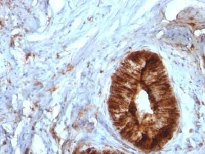 Immunohistochemistry-Paraffin: beta 2-Microglobulin Antibody (B2M/961) - Azide and BSA Free [NBP2-47704]