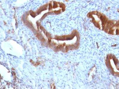 Immunohistochemistry-Paraffin: beta 2-Microglobulin Antibody (B2M/961) - IHC-Prediluted [NBP2-48345]