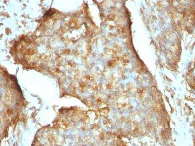 Immunohistochemistry-Paraffin: beta 2-Microglobulin Antibody (B2M/961) - IHC-Prediluted [NBP2-48345]