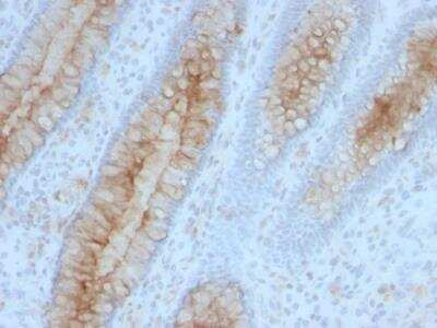 Immunohistochemistry-Paraffin: beta 2-Microglobulin Antibody (B2M/961) - IHC-Prediluted [NBP2-48345]