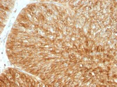 Immunohistochemistry-Paraffin: beta 2-Microglobulin Antibody (B2M/961) [NBP2-44471]