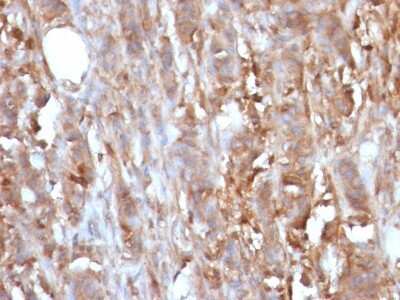 Immunohistochemistry-Paraffin: beta 2-Microglobulin Antibody (B2M/961) [NBP2-44471]