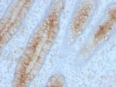 Immunohistochemistry-Paraffin: beta 2-Microglobulin Antibody (B2M/961) [NBP2-44471]