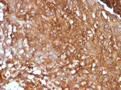 Immunohistochemistry-Paraffin: beta 2-Microglobulin Antibody (B2M/961) [NBP2-44471]