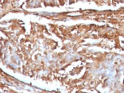 Immunohistochemistry-Paraffin: beta 2-Microglobulin Antibody (B2M/961) [NBP2-44471]