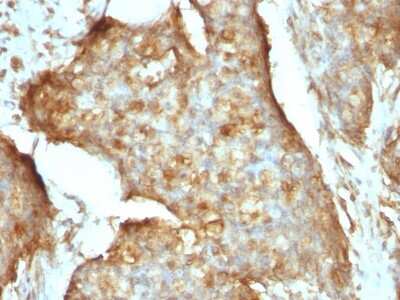 Immunohistochemistry-Paraffin: beta 2-Microglobulin Antibody (B2M/961) [NBP2-44471]