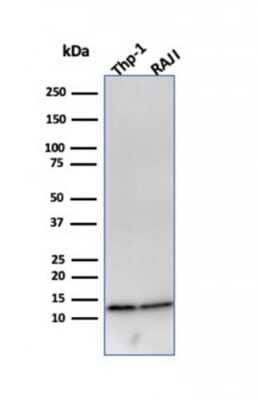 Western Blot: beta 2-Microglobulin Antibody (B2M/961) [NBP2-44471]