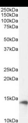 Western Blot: beta 2-Microglobulin Antibody (BBM.1)ChimericAzide and BSA Free [NBP2-81045]