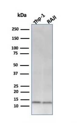 Western Blot: beta 2-Microglobulin Antibody (C21.48A1)Azide and BSA Free [NBP3-11404]