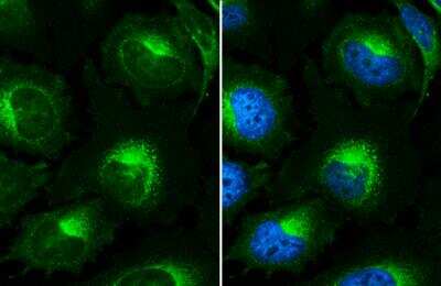 Immunocytochemistry/ Immunofluorescence: beta 2-Microglobulin Antibody [NBP2-15566]