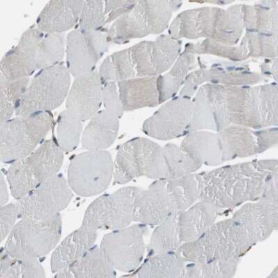 Immunohistochemistry-Paraffin: beta 2-Microglobulin Antibody [NBP1-87482]