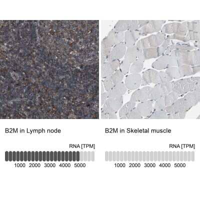 Immunohistochemistry-Paraffin: beta 2-Microglobulin Antibody [NBP1-87482]