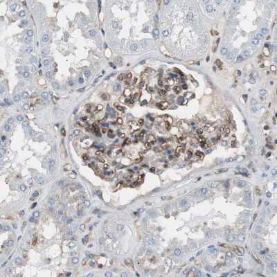 Immunohistochemistry-Paraffin: beta 2-Microglobulin Antibody [NBP1-87482]