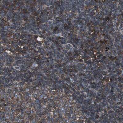 Immunohistochemistry-Paraffin: beta 2-Microglobulin Antibody [NBP1-87482]