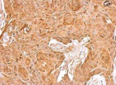 Immunohistochemistry-Paraffin: beta 2-Microglobulin Antibody [NBP2-15566]