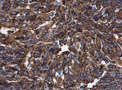 Immunohistochemistry-Paraffin: beta 2-Microglobulin Antibody [NBP2-15566]