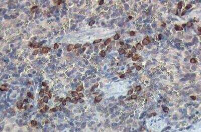 Immunohistochemistry-Paraffin: beta 2-Microglobulin Antibody [NBP2-15566]