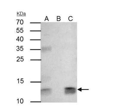 Immunoprecipitation: beta 2-Microglobulin Antibody [NBP2-15566]