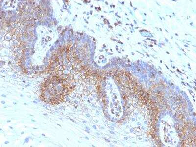 Immunohistochemistry-Paraffin: beta 2-Microglobulin Antibody (SPM617) - IHC-Prediluted [NBP2-48328]