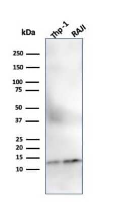 Western Blot: beta 2-Microglobulin Antibody (SPM617) [NBP2-44468]