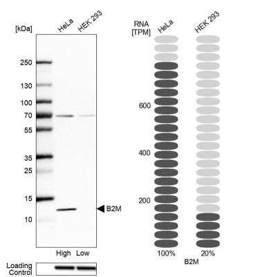 Western Blot: beta 2-Microglobulin Antibody [NBP1-87482]