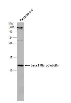 Western Blot: beta 2-Microglobulin Antibody [NBP2-15566]