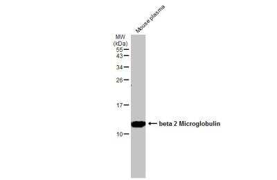 Western Blot: beta 2-Microglobulin Antibody [NBP2-15566]