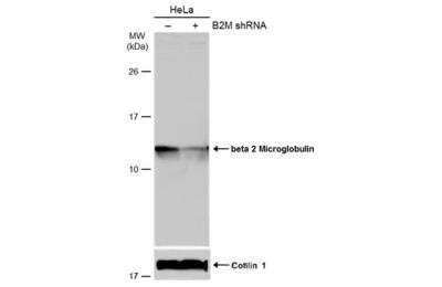 Western Blot: beta 2-Microglobulin Antibody [NBP2-15566]