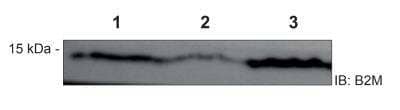 Western Blot: beta 2-Microglobulin Antibody [NBP2-15566]