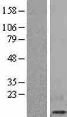 Western Blot: beta 2-Microglobulin Overexpression Lysate [NBL1-07874]