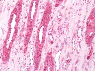 Immunohistochemistry-Paraffin: beta-3 Adrenergic R/ADRB3 Antibody - BSA Free [NBP2-29495]