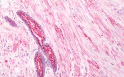 Immunohistochemistry-Paraffin: beta-3 Adrenergic R/ADRB3 Antibody - BSA Free [NBP2-29495]