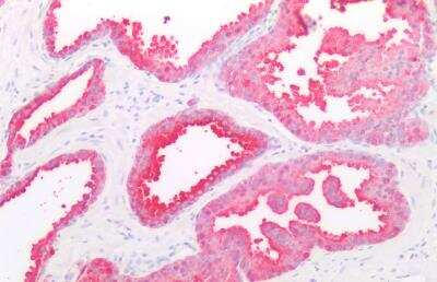 Immunohistochemistry-Paraffin: beta-3 Adrenergic R/ADRB3 Antibody [NBP2-88830]