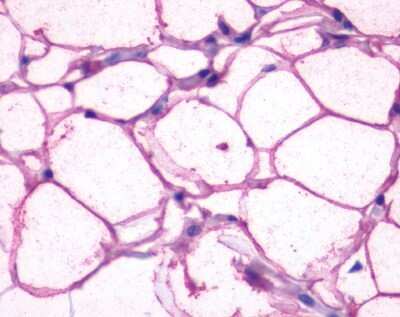 Immunohistochemistry-Paraffin: beta-3 Adrenergic R/ADRB3 Antibody - BSA Free [NLS4198]