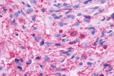 Immunohistochemistry-Paraffin: beta-3 Adrenergic R/ADRB3 Antibody - BSA Free [NLS4198]