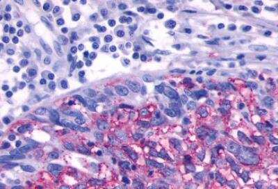Immunohistochemistry-Paraffin: beta-3 Adrenergic R/ADRB3 Antibody - BSA Free [NLS4198]