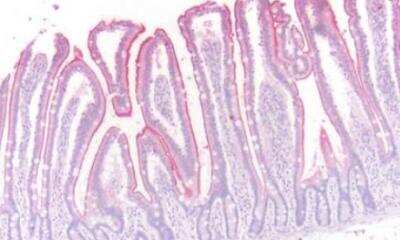 Immunohistochemistry-Paraffin: beta-3 Adrenergic R/ADRB3 Antibody - BSA Free [NLS4198]