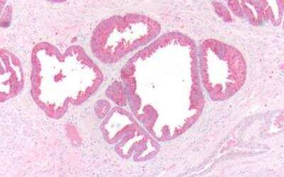 Immunohistochemistry-Paraffin: beta-3 Adrenergic R/ADRB3 Antibody - BSA Free [NLS4198]