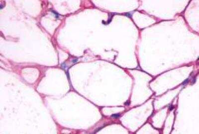 Immunohistochemistry-Paraffin: beta-3 Adrenergic R/ADRB3 Antibody - BSA Free [NLS4198]