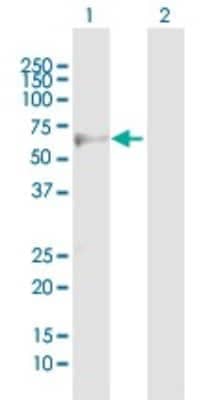 Western Blot: beta-3 Adrenergic R/ADRB3 Antibody [H00000155-B01P]