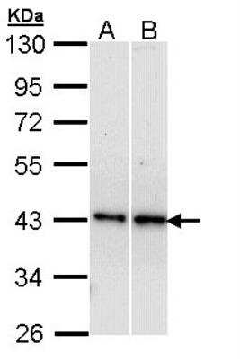 Western Blot: beta-3 Adrenergic R/ADRB3 Antibody [NBP2-15567]