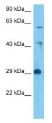 Western Blot: beta-3 Adrenergic R/ADRB3 Antibody [NBP3-10867]