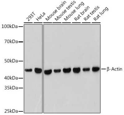 Western Blot: beta-Actin Antibody (4C4) [NBP3-16886]