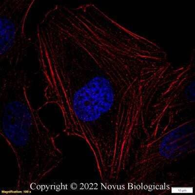 Immunocytochemistry/ Immunofluorescence: beta-Actin Antibody (8H10D10) - BSA Free [NBP1-47423]