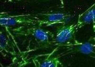 Immunocytochemistry/ Immunofluorescence: beta-Actin Antibody (AC-15) [NB600-501]